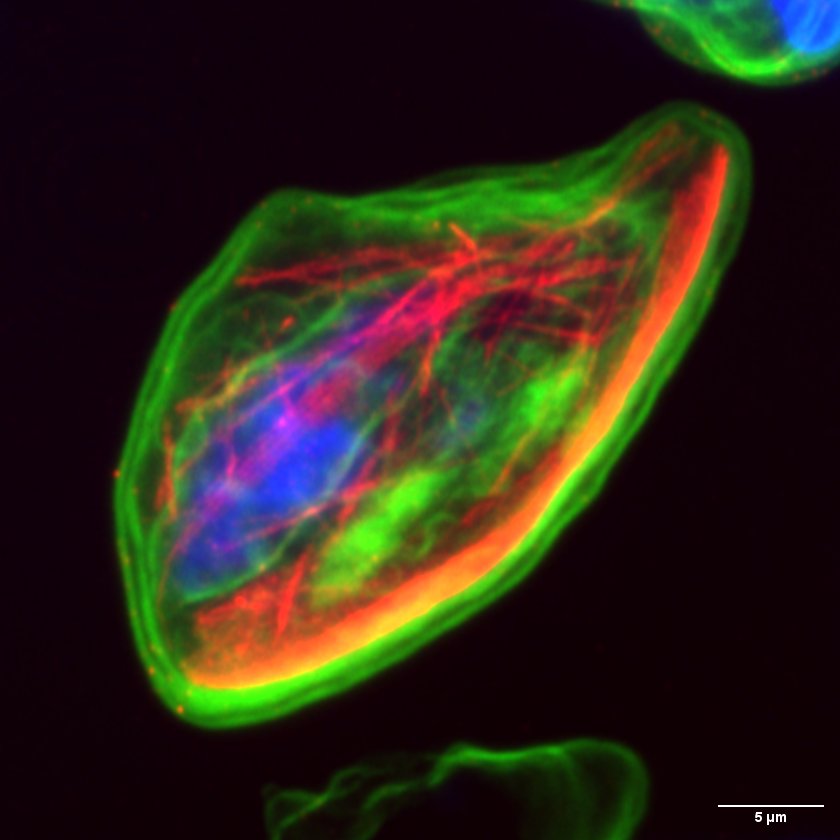Plasmodium falciparum gametocyte microtubules by Jiahong Li, Elyra/LSM880